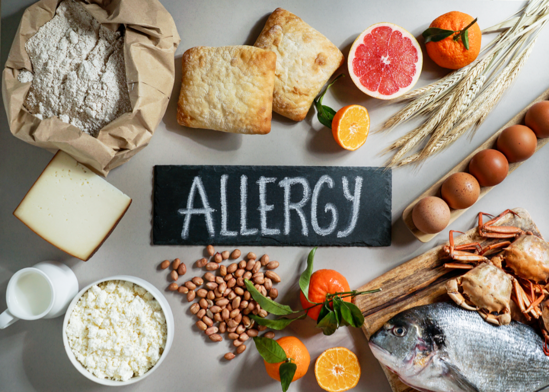 Naturopathic approach to allergies
